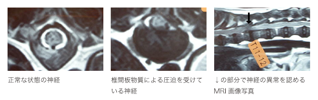 レントゲン写真